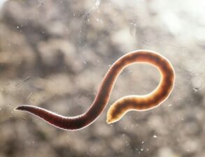 človeški parazitski črv